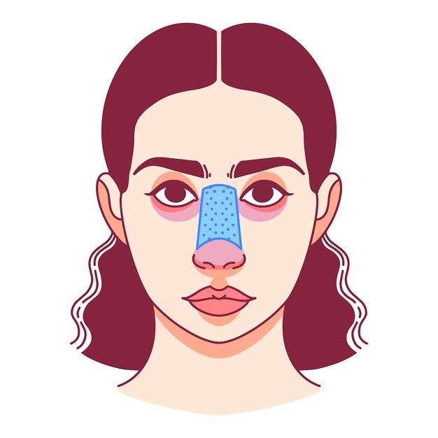 عمليات تجميل الأنف: